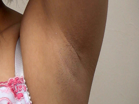 素人娘の全裸図鑑22　今時の女の子12名が恥らいながら脱衣していく様子をじっくり撮影した、変態紳士のためのヘアヌードコレクション　サンプル画像10